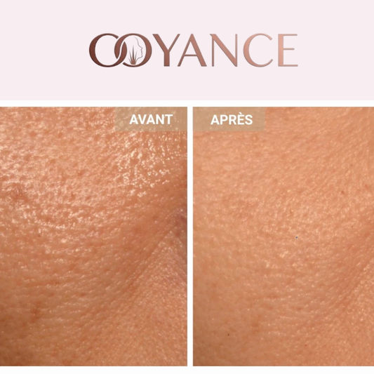 OOYANCE - MASQUE LED VISAGE